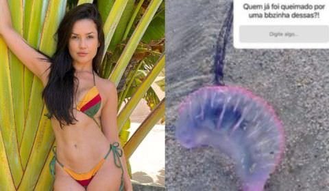 Juliette sofre queimadura de água-viva: ‘Pense em uma dor’