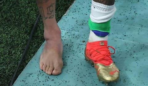 Neymar intensifica tratamento no hotel, anima torcida, mas não tem volta confirmada: veja vídeo