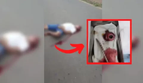 Vídeo: Homem tem olho arrancado após grave acidente, no São Francisco