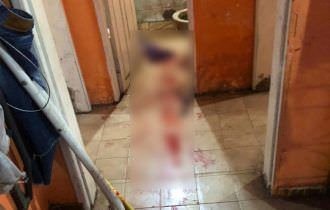 Bandidos quase matam idoso espancado durante roubo em residência