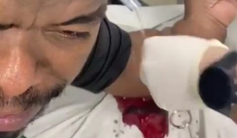 Japonês da Federal leva tiro durante assalto em Manaus