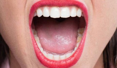 Mulher arranca língua de estuprador com mordida e entrega pedaço à polícia na França