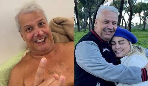 Sikêra Jr. aparece com rosto machucado após receber alta do hospital