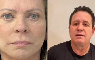 De Christina Rocha a Marrone: veja famosos que fizeram harmonização facial e não mudaram nada