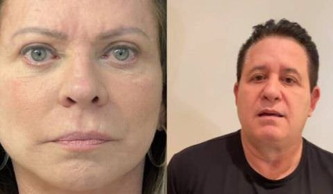 De Christina Rocha a Marrone: veja famosos que fizeram harmonização facial e não mudaram nada