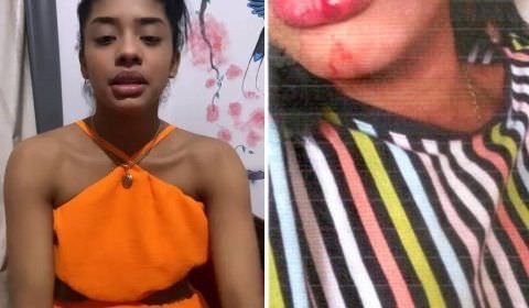 Laudo confirma lesões em ex-vocalista da Feras do Forró agredida por cantor Maykinho