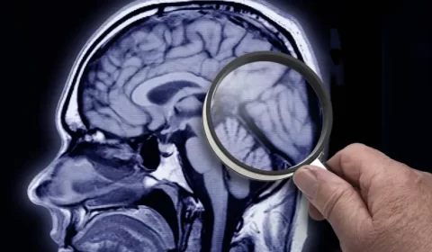 Síndrome de Tourette: veja as causas e sintomas para a doença marcada por tiques