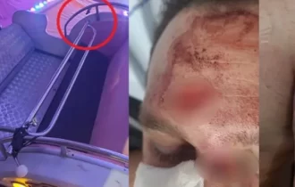 Vídeo: homem sofre fratura após ser arremessado de brinquedo