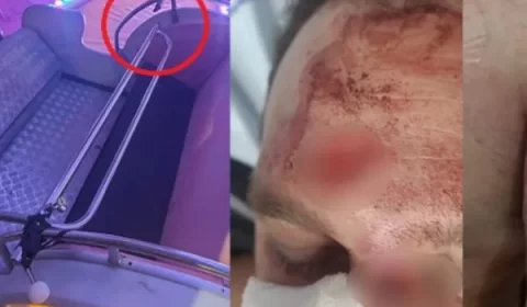 Vídeo: homem sofre fratura após ser arremessado de brinquedo