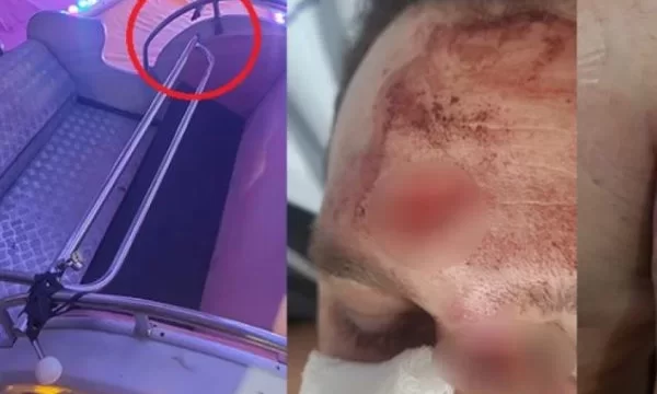Vídeo: homem sofre fratura após ser arremessado de brinquedo