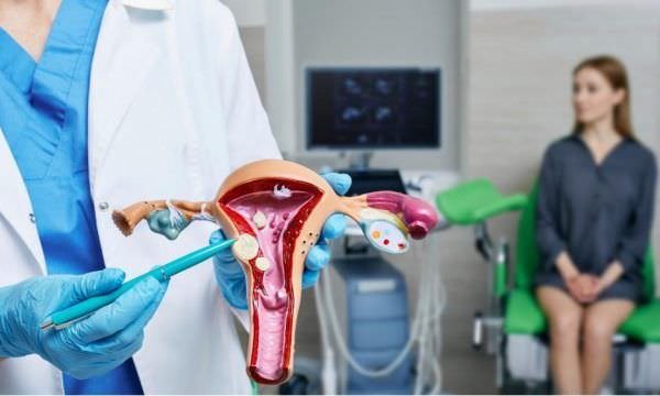 Miomas uterinos afetam até 70% das mulheres, mas raramente levam à infertilidade feminina