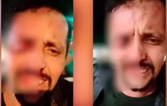 Vídeo: homem é confundido com bandido e perde o olho em briga