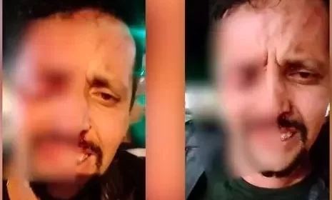 Vídeo: homem é confundido com bandido e perde o olho em briga