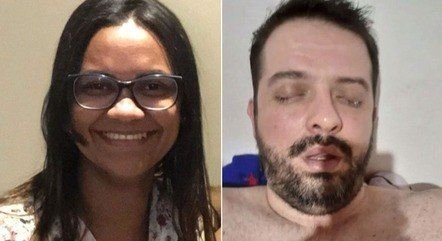 Mulher suspeita de colar olho do marido e tentar envenená-lo vai a júri popular nesta quinta-feira