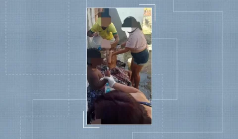 Criança com desnutrição aguda é resgatada de casa na Zona Leste de Manaus