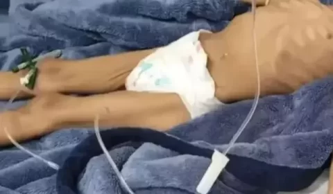 Menina deixada pelo pai 40 dias sem comer não consegue beber água