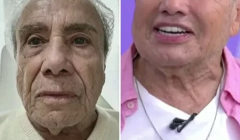 Stênio Garcia faz harmonização geral e resultado choca web