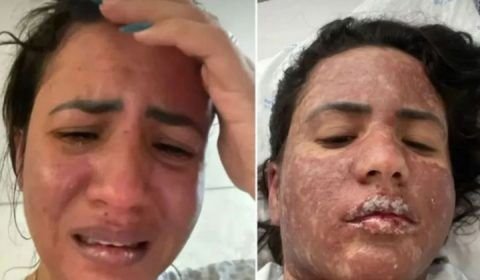 Entenda a síndrome rara que acomete a mulher do cantor Frank Aguiar