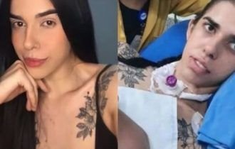 Jovem internada há 5 meses por cheirar pimenta tem melhora clínica