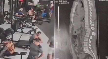 Homem que sofreu acidente em academia do Ceará tem 1% de chance de voltar a andar