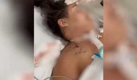 Mulher perde bebê após levar 20 facadas da ex do namorado