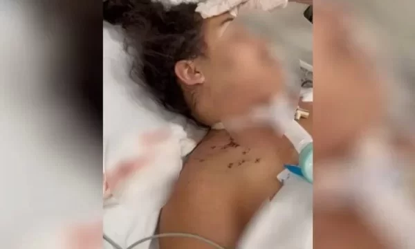 Mulher perde bebê após levar 20 facadas da ex do namorado