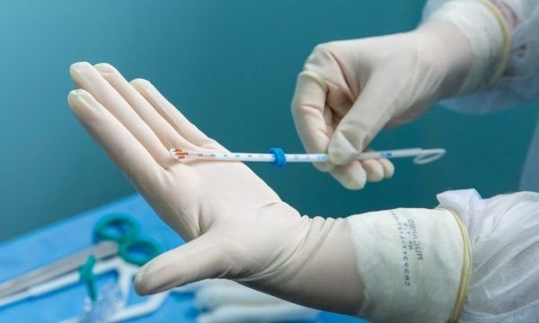 Prefeitura amplia acesso ao DIU e prevê oferta do método contraceptivo em mais nove USFs neste ano