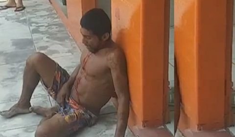 Homem fica gravemente ferido após tentativa de roubo em Manicoré