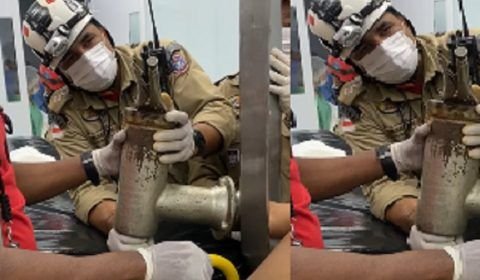 Açougueiro perde a mão em acidente em Manaus
