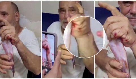 Pescador é atingido por peixe bagre e tem mão perfurada