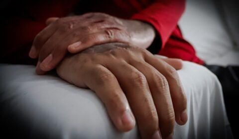 foto-maos-queimadura-scaled