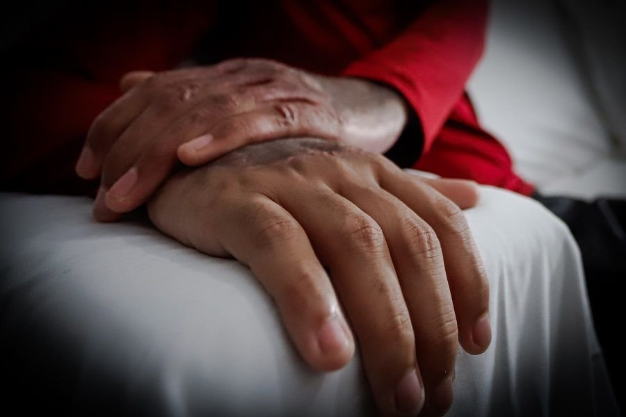 foto-maos-queimadura-scaled