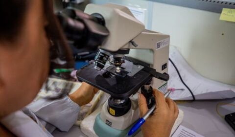 Prefeitura de Manaus inicia oferta de preventivo em meio líquido na zona rural