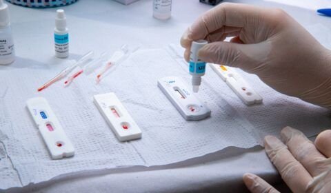 ‘Dezembro Vermelho’ terá como foco prevenção, diagnóstico, tratamento precoce e combate ao preconceito