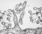 hantavirus-reacende-alerta-no-