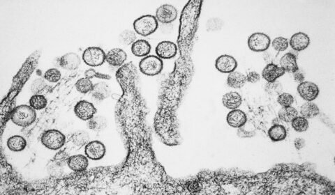 hantavirus-reacende-alerta-no-