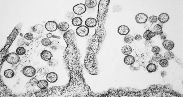 hantavirus-reacende-alerta-no-