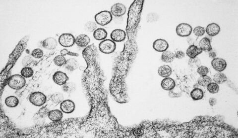 hantavirus-reacende-alerta-no-