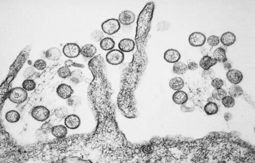 hantavirus-reacende-alerta-no-