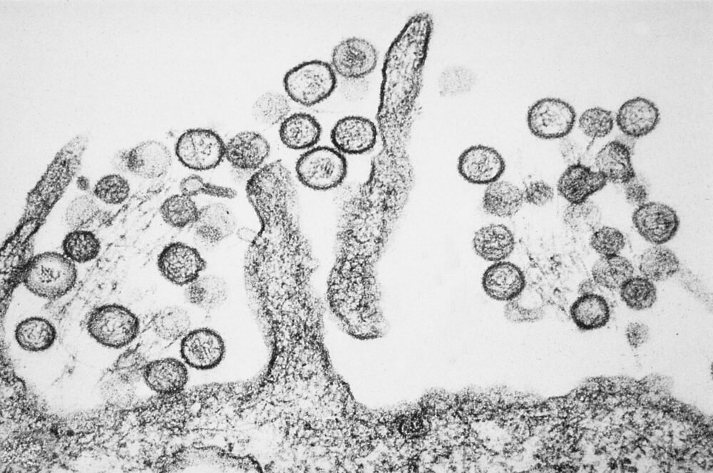 hantavirus-reacende-alerta-no-
