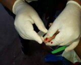 Prefeitura de Manaus reforça alerta sobre risco de transmissão de malária em balneários e locais favoráveis aos criadouros naturais do mosquito Anopheles